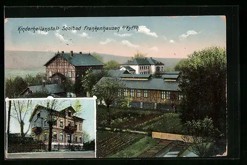 AK Frankenhausen a. Kyffh., Kinderheilanstalt Soolbad