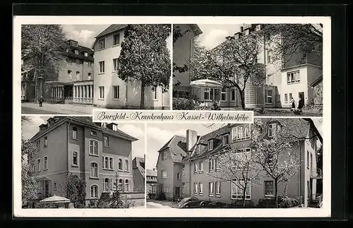 AK Kassel-Wilhelmshöhe, das Burgfeld-Krankenhaus, Aussenansichten