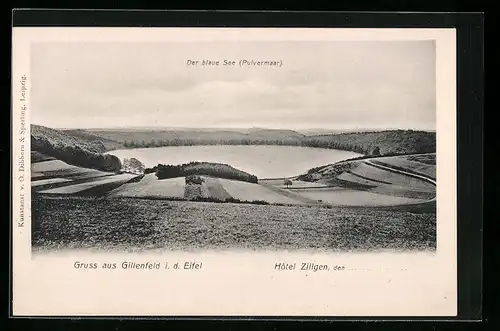 AK Gillenfeld i. d. Efel, Hotel Zillgen, Der blaue See