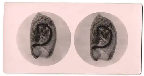 Stereo-Fotografie Makroaufnahme, Mikroskopische Vergrösserung, Medizin, Biologie