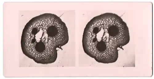 Stereo-Fotografie Makroaufnahme, Mikroskopische Vergrösserung, Medizin, Biologie