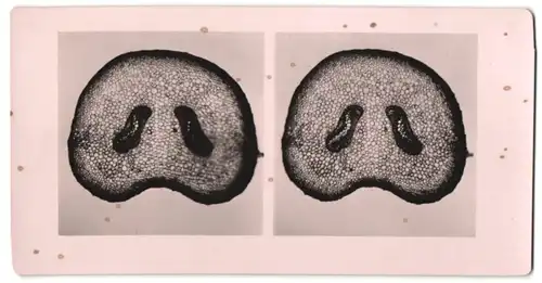 Stereo-Fotografie Makroaufnahme, Mikroskopische Vergrösserung, Medizin, Biologie