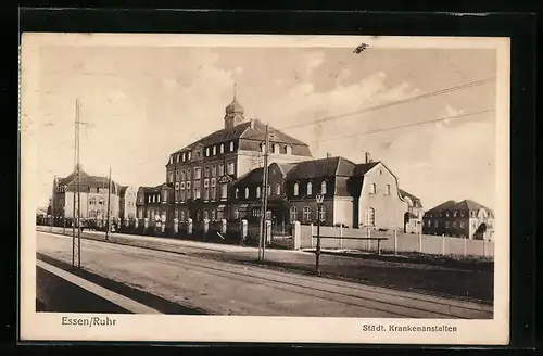 AK Essen /Ruhr, Städtische Krankenanstalten mit Strassenpartie