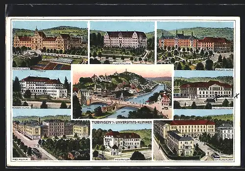 Künstler-AK Tübingen a. N., verschiedene Ansichten der Universitätskliniken