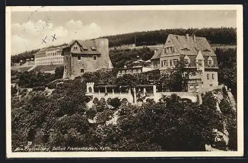 AK Frankenhausen /Kyffh., Ansicht der Frankenburg
