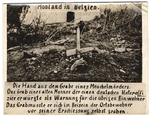 Fotografie Post mortem, Mondland in Beglgien, Hand aus dem Grab eines Meuschelmörders der deutschen Uffz. erwürgte