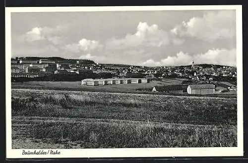 AK Baumholder /Nahe, Blick über Wiesen zur Ortschaft