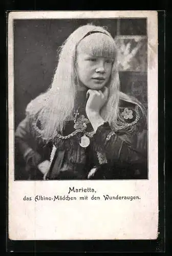 AK Marietta, das Albino-Mädchen mit den Wunderaugen