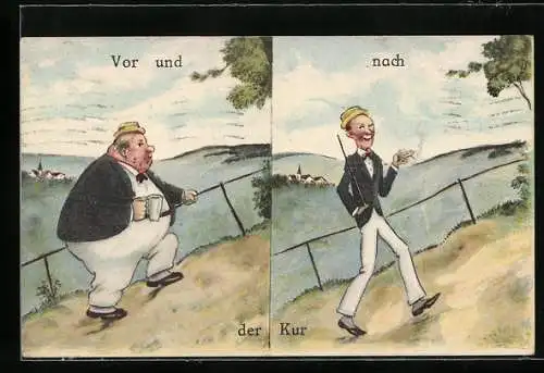 AK Kurgast als übergewichtiger Mann vor der Kur und als schlanker Mann nach der Kur