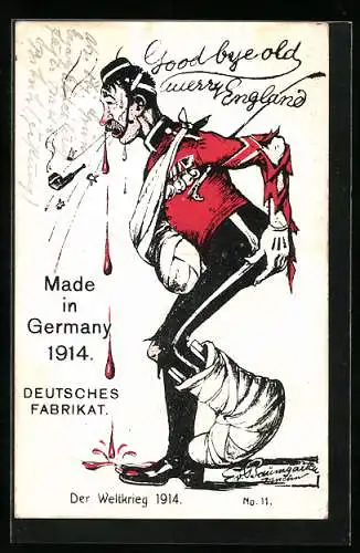 AK Propaganda 1. Weltkrieg, Made in Germany 1914, Soldat mit Verletzungen hält sich den Po, Gips am Fuss