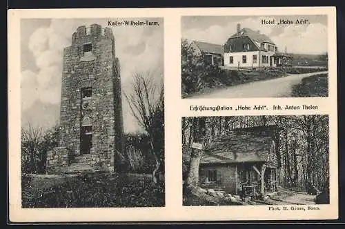 AK Adenau, Hohe Acht mit Hotel zur hohen Acht, Blockhaus Erfrischungsstation, Kaiser Wilhelm Turm