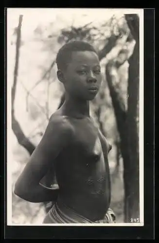 Fotografie Leopold Gabriel, Katanga, Junge Kongolesin mit Skarifizierung auf dem Bauch