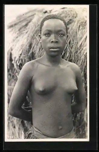 Fotografie Leopold Gabriel, Katanga, Junge Kongolesin mit Skarifizierung auf ihrem Bauchbereich