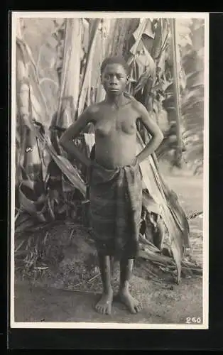 Fotografie Leopold Gabriel, Katanga, Junge kongolesische Frau mit Skarifizierung auf dem Bauch