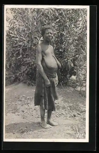 Fotografie Leopold Gabriel, Katanga, Halbnackte ältere kongolesische Frau