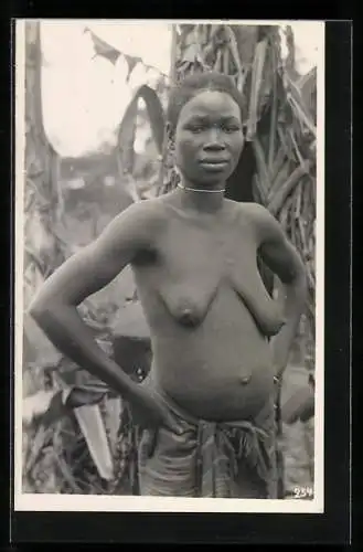 Fotografie Leopold Gabriel, Katanga, Halbnackte kongolesische Frau mit Skarifizierung und einem Halsband