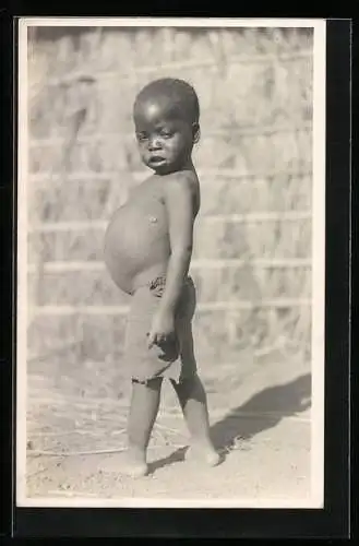 Fotografie Leopold Gabriel, Katanga, Ein kongolesischer Junge mit dickem Bauch