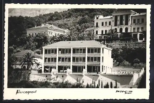 AK Herceqnovi, Berghang mit Hotels