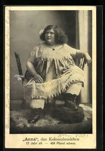 AK Anna, das Kolossalmädchen, 17 Jahr alt, 404 Pfund schwer