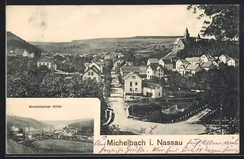 AK Michelbach i. Nassau, Michelsbacher Hütte, Teilansicht mit Strassenpartie