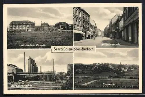 AK Saarbrücken-Burbach /Saar, Krankenhaus Rastphul, Burbacher Hütte und Wilhelmstrasse