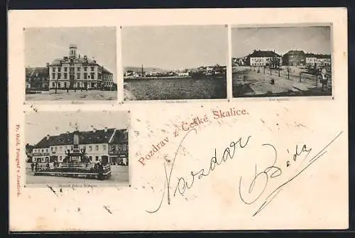 AK Ceska Skalice, Radnice, Cast namesti, Pomnik Bozeny Nemocove
