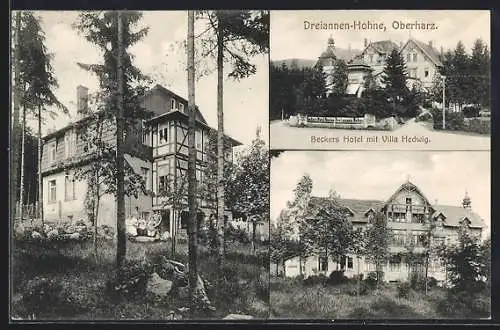 AK Dreiannen-Hohe /Oberharz, Beckers Hotel mit Villa Hedwig