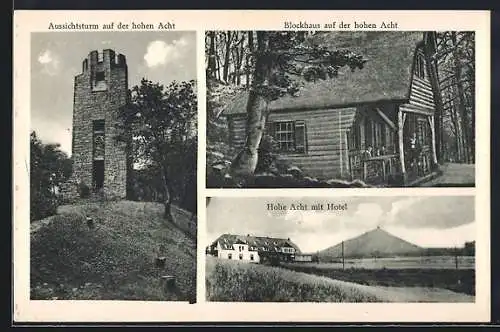 AK Adenau, Aussichtsturm, Hotel und Blockhaus auf der hohen Acht