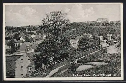 AK Eupen, Partie Unterstadt, Hütte
