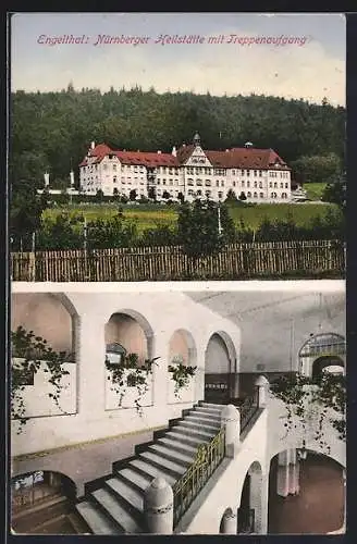 AK Engelthal / Frankenalb, Nürnberger Heilstätte mit Treppenaufgang