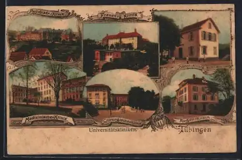 AK Tübingen, Psychartrische Klinik, Frauen-Klinik, Chirugische Klinik, Ohren-Klinik