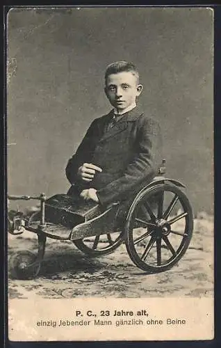 AK Cöln a. Rh., Peter Càspers, 19-jähriger Mann ohne Beine