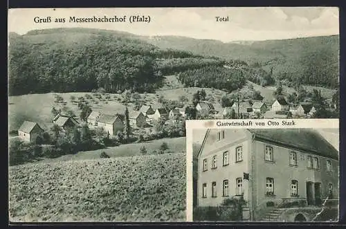 AK Gundersweiler, Messersbacherhof /Pfalz, Gasthaus Otto Stark, Totalansicht mit Waldblick