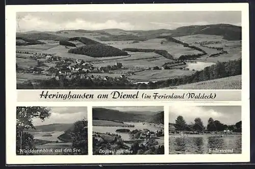 AK Heringhausen / Diemelsee, Walddurchblick auf den See, Dorfteil, Badestrand