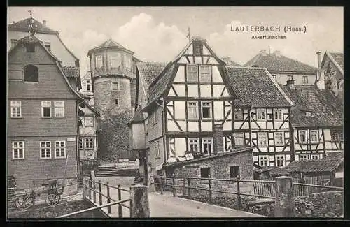 AK Lauterbach / Hessen, Das Ankertürmchen mit Häusern im Fachwerkstil
