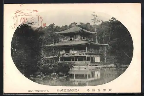 AK Kyoto, Kinkakuji