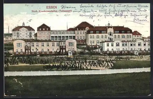 AK Essen / Ruhr, Städtische Krankenanstalten, Teilansicht