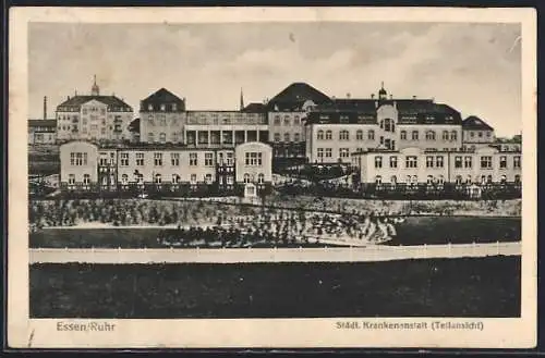 AK Essen /Ruhr, Städtische Krankenanstalt, Teilansicht