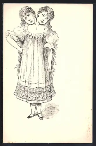 Künstler-AK Siamesischer Zwilling mit zwei Köpfen