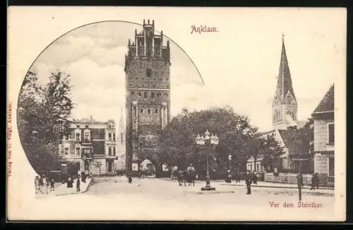 AK Anklam, Vor dem Steinthor