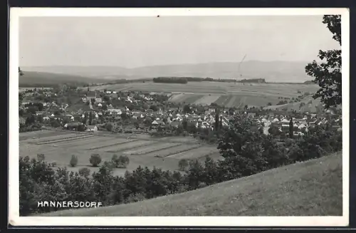 AK Hannersdorf, Ortsansicht mit Feldern und Hügeln