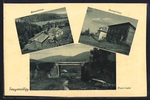 AK Fenyvesvölgy, Szanatórium, Patakrészlet