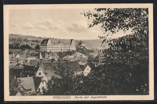 AK Tübingen, Partie mit Augenklinik