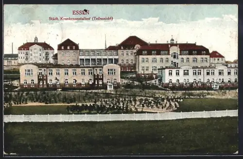 AK Essen / Ruhr, Städtische Krankenanstalten, Teilansicht