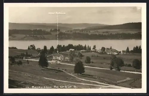 AK Malbuisson, Vue sur le Lac avec Hôtel Bellevue