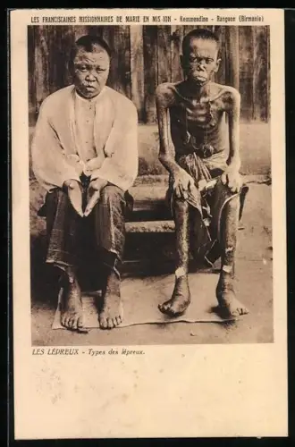 AK Zwei Leprakranke, Types des lépreux, Französische Mission