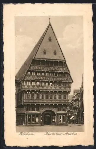 AK Hildesheim, Knochenhauer-Amtshaus