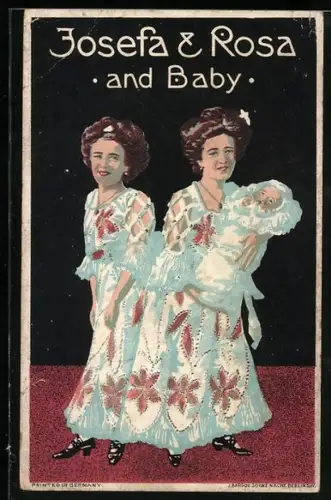 AK Josefa & Rosa and Baby, Siamesische Zwillinge