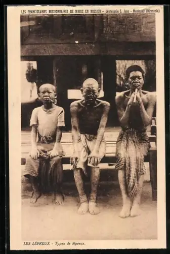 AK Mandalay /Birmanie, Drei Leprakranke
