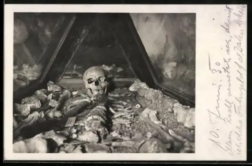 AK Hallstatt, Bergmannsskelett